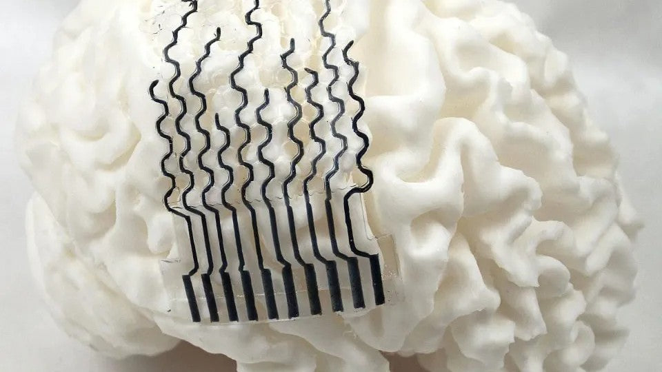 Custom 3D-printed brain electrodes improve neural fit
